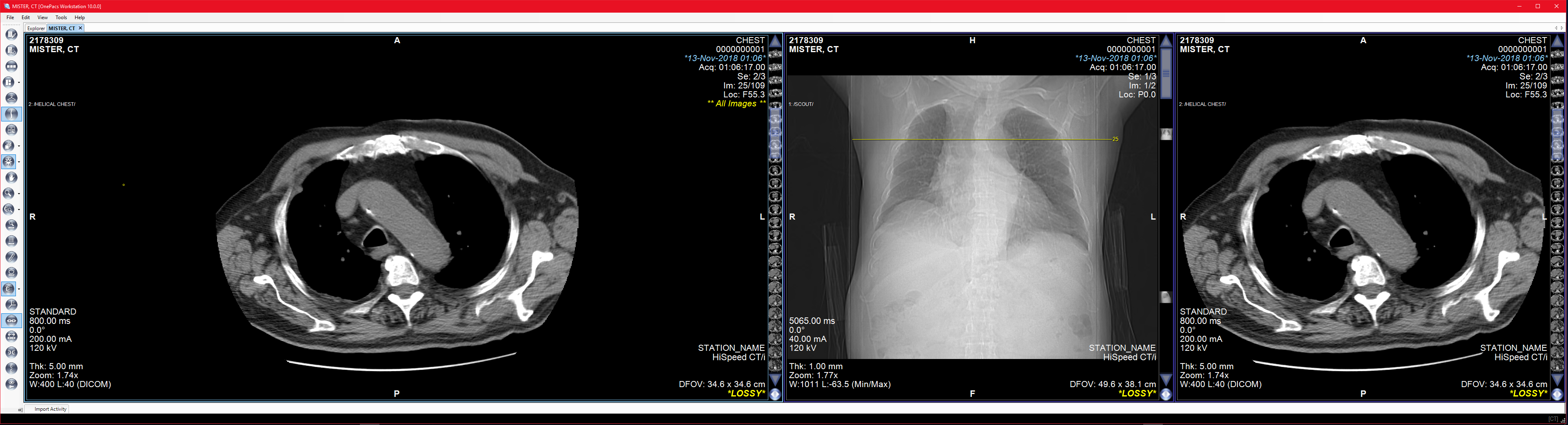OnePacs Desktop for Windows > Multiple Monitor Usage > window 2-1.PNG