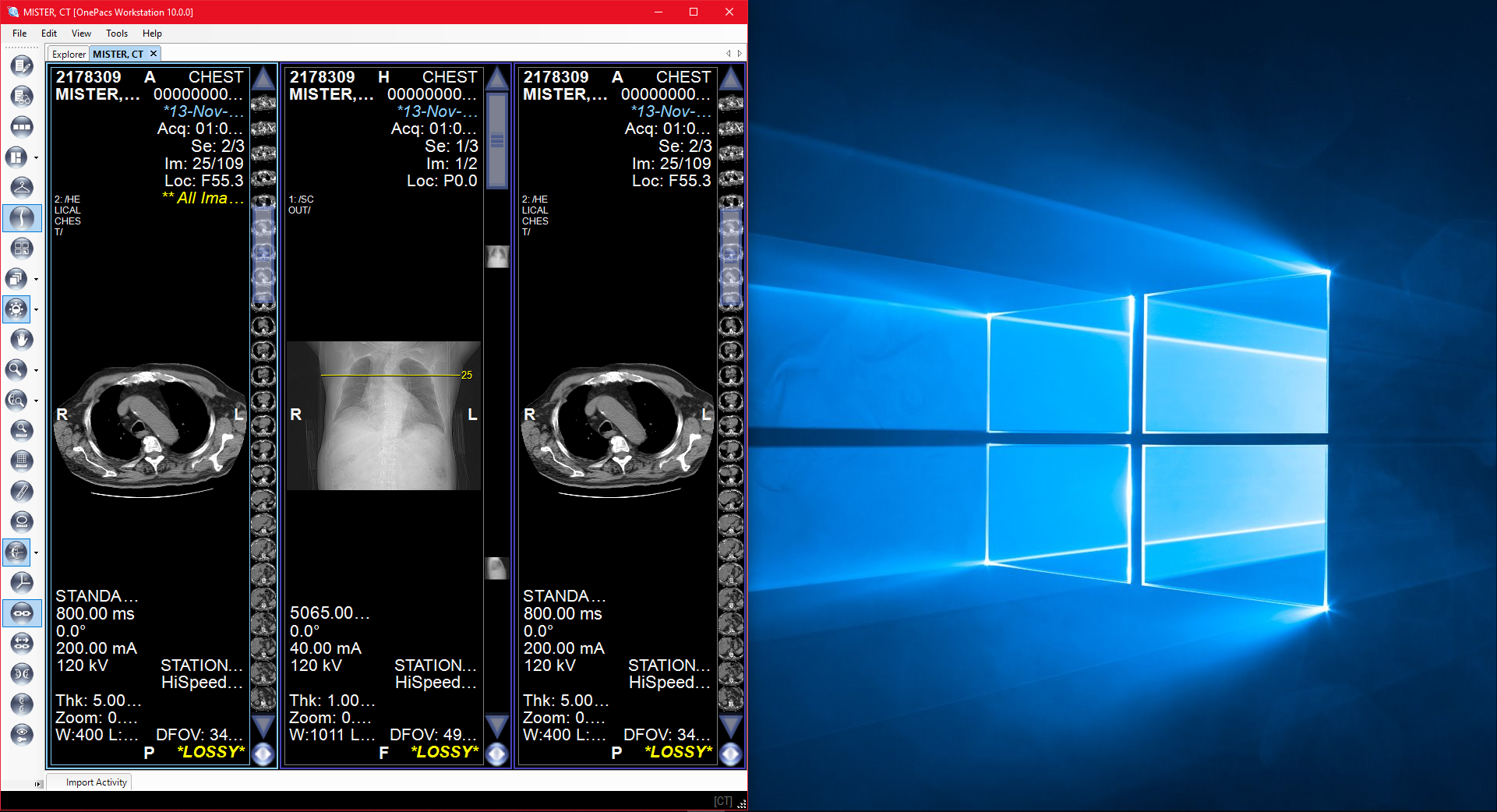 OnePacs Desktop for Windows > Multiple Monitor Usage > window 2-2.PNG